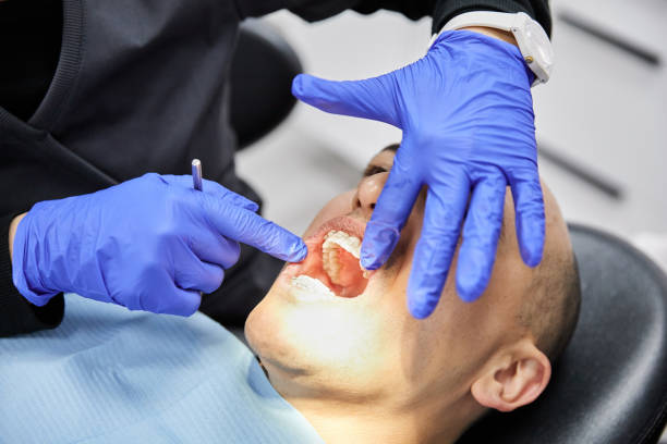 Best Emergency Dental Care for Broken or Chipped Teeth in Corbin, KY